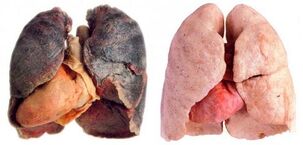 Lungen des Rauchers und gesund